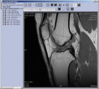 knee_mri_1.jpg