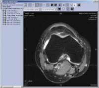 knee_mri_2.jpg
